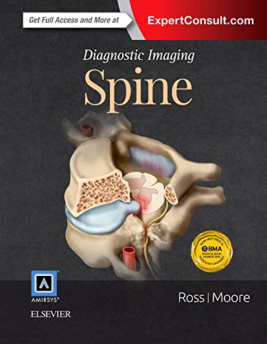 Diagnostic Imaging: Spine: ExpertConsult.com